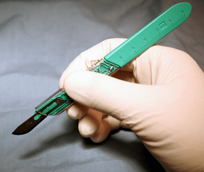 Gloved hand holding a green-handled scalpel, prepared for incision.